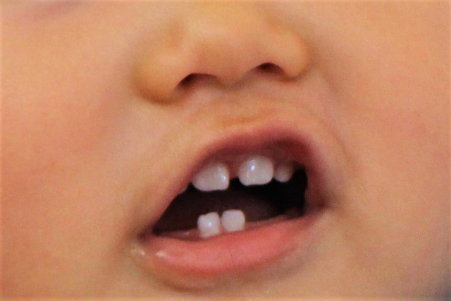 虫歯と風邪を予防 赤ちゃんの歯磨きはいつから ガーゼや歯ブラシは使う 子育ての悩み 相談に 子育てのミカタ